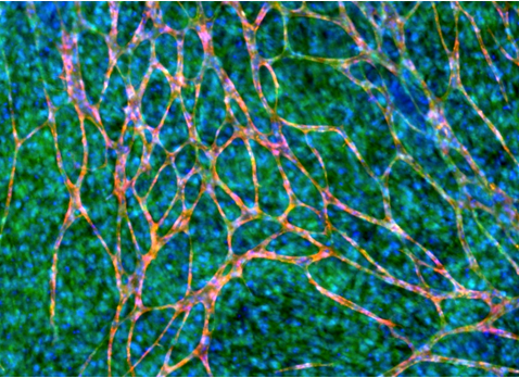 Engineered Full Thickness Vascularized Human Skin Tissue using 3D Bioprinting